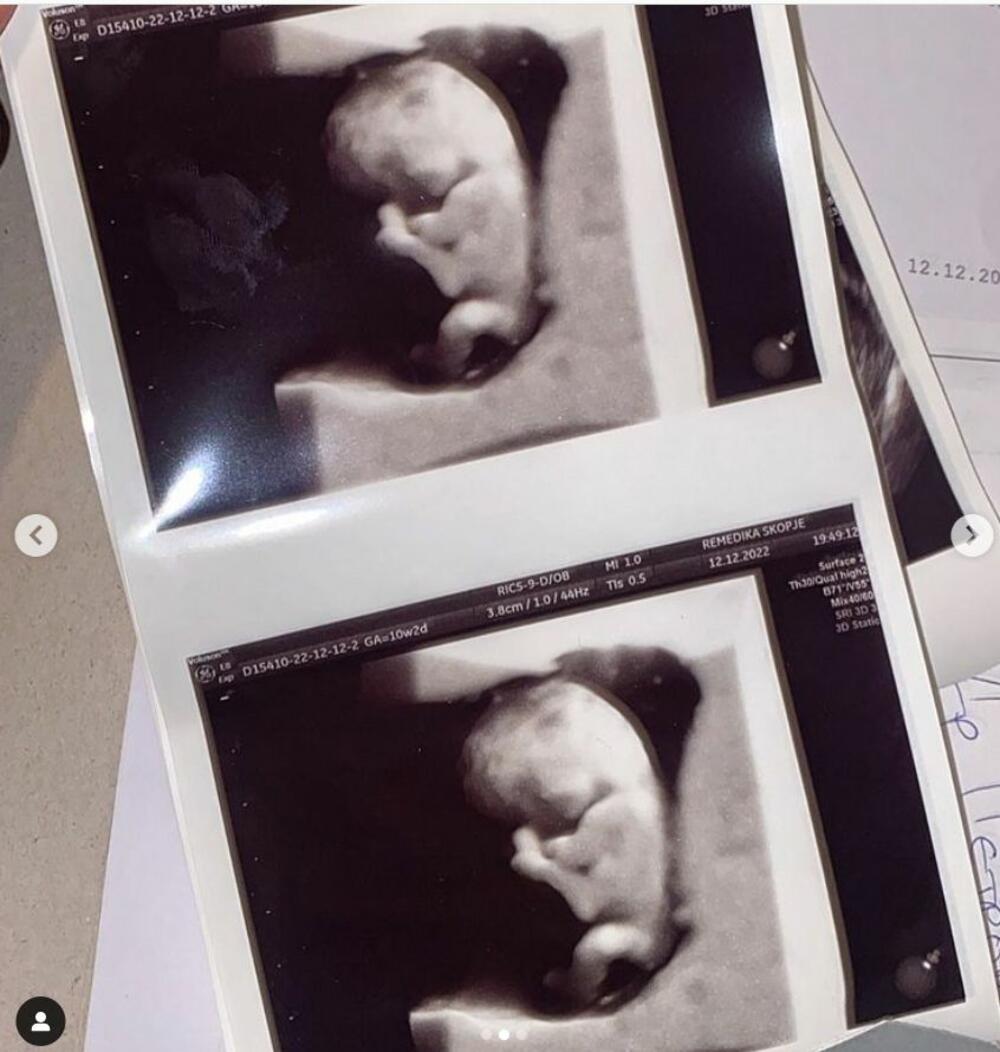 Tara Simov otkrila da je u drugom stanju