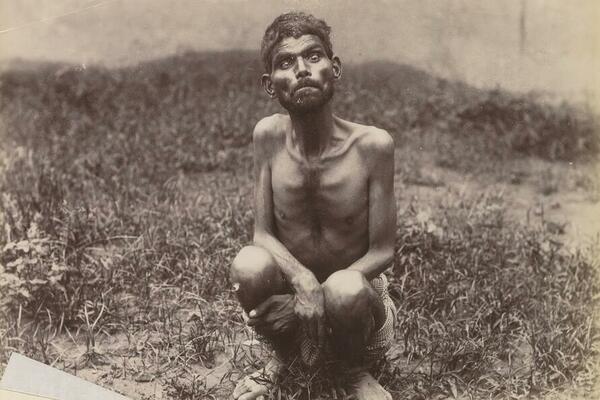 ODGAJALI GA VUKOVI, A LOVILI LJUDI: Dečak hodao ČETVORONOŠKE, jeo samo SIROVO MESO, i OŠTRIO ZUBE glodanjem KOSTIJU