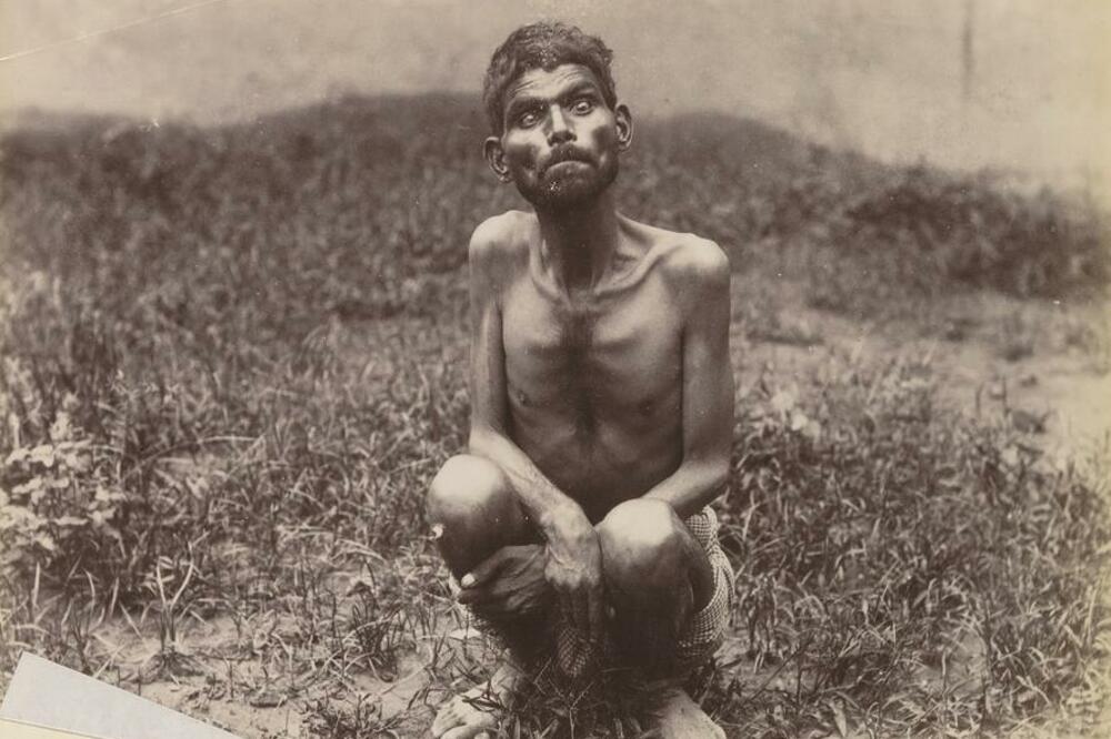 ODGAJALI GA VUKOVI, A LOVILI LJUDI: Dečak hodao ČETVORONOŠKE, jeo samo SIROVO MESO, i OŠTRIO ZUBE glodanjem KOSTIJU