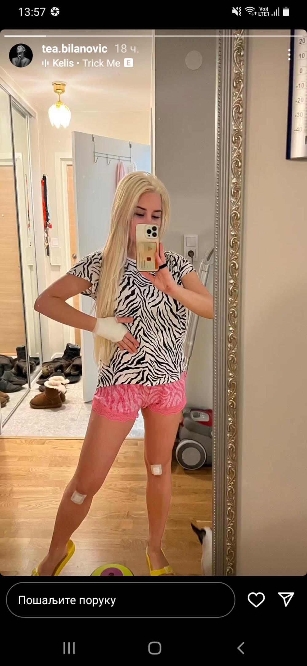 Zavoj na rukama i flasteri na kolenima