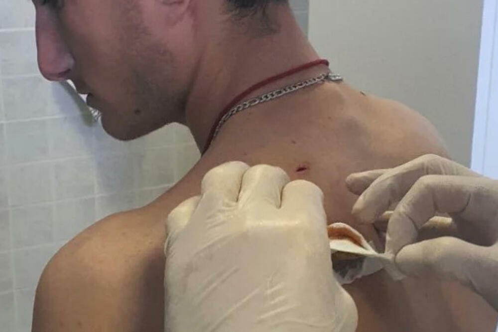 "NA PUTU KA KUĆI ONI SU GA NAPALI": Oglasio se otac o brutalnom napadu na njegovog sina