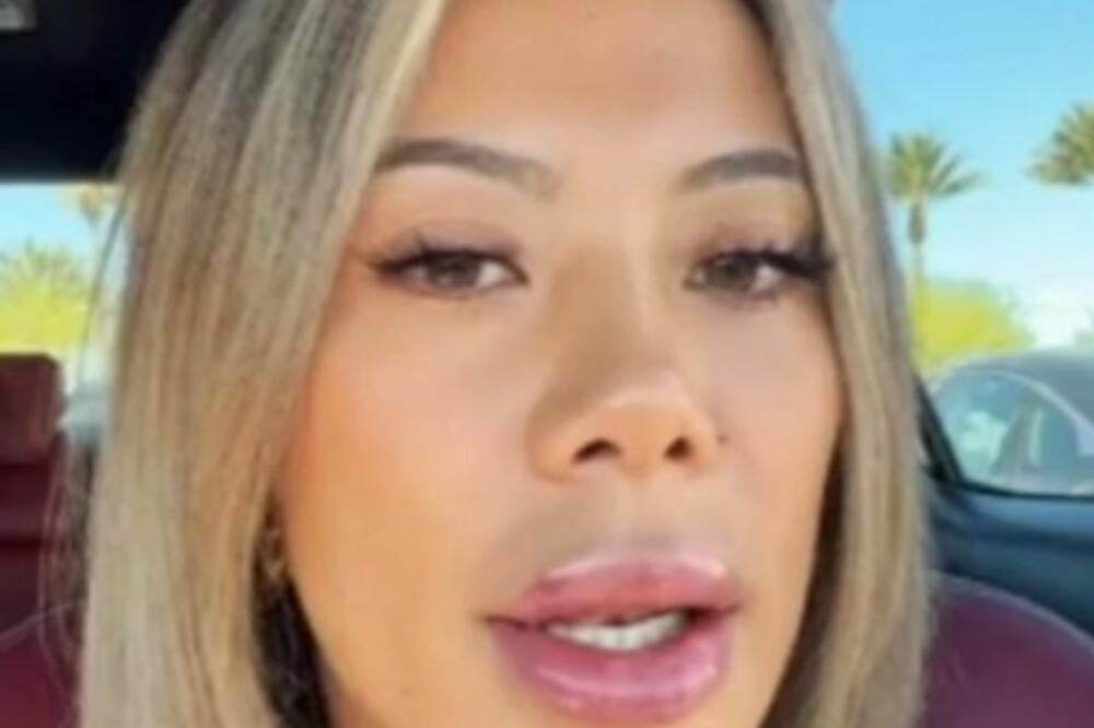 ŽENA URADILA USNE, LJUDI MASOVNO KRENULI DA JE NAPADAJU: Pogledajte kako sada IZGLEDA, ovakve NEMA NIKO NA SVETU