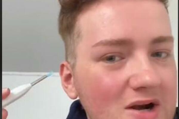 POKAZAO ŠTA MU JE GODINAMA BILO ZAGLAVLJENO U UHU: Od ovoga će vam se ŽELUDAC OKRENUTI (VIDEO)