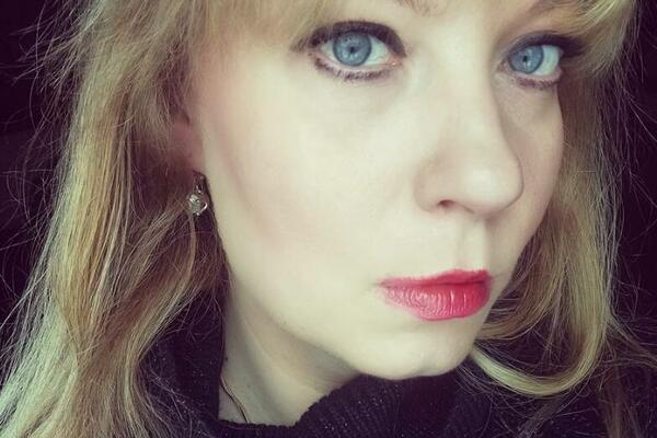 GLUMICA JE TADA ZA DLAKU IZBEGLA SMRT, JEZIVE POVREDE GLAVE: Evo kako je došlo do NEZGODE i kako je IZGLEDALA