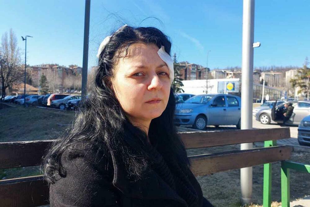 "VRIŠTALA SAM, BILA SAM KRVAVA": Tamara iz Bora koju su izujedali stafordi ispričala koji HOROR je doživela!