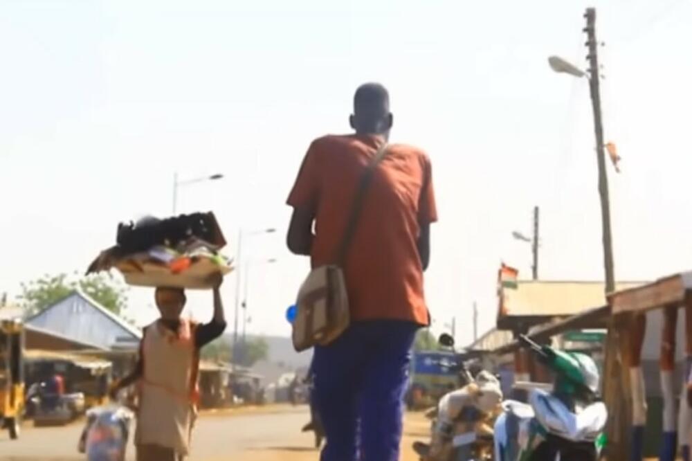 IMA SKORO 3 METRA I NE PRESTAJE DA RASTE: Lekari ZAPANJENI,jedva ulazi na VRATA,a tek da čujete kako ga MERE! VIDEO