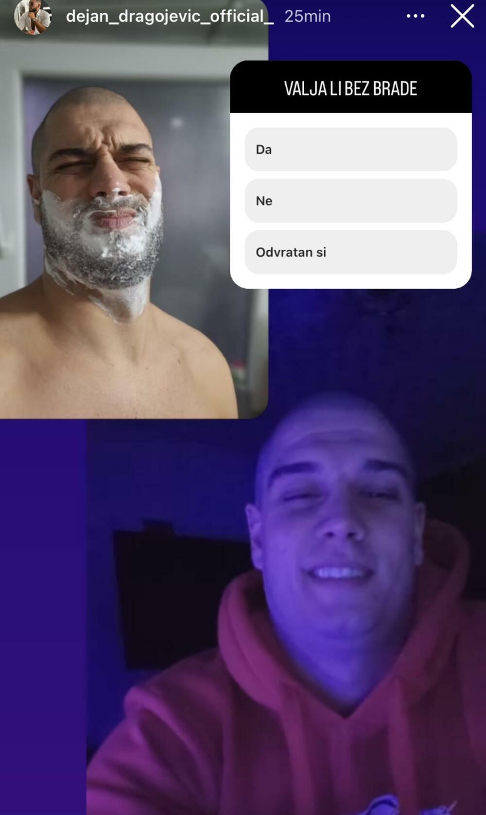 Da li vam se dopada?