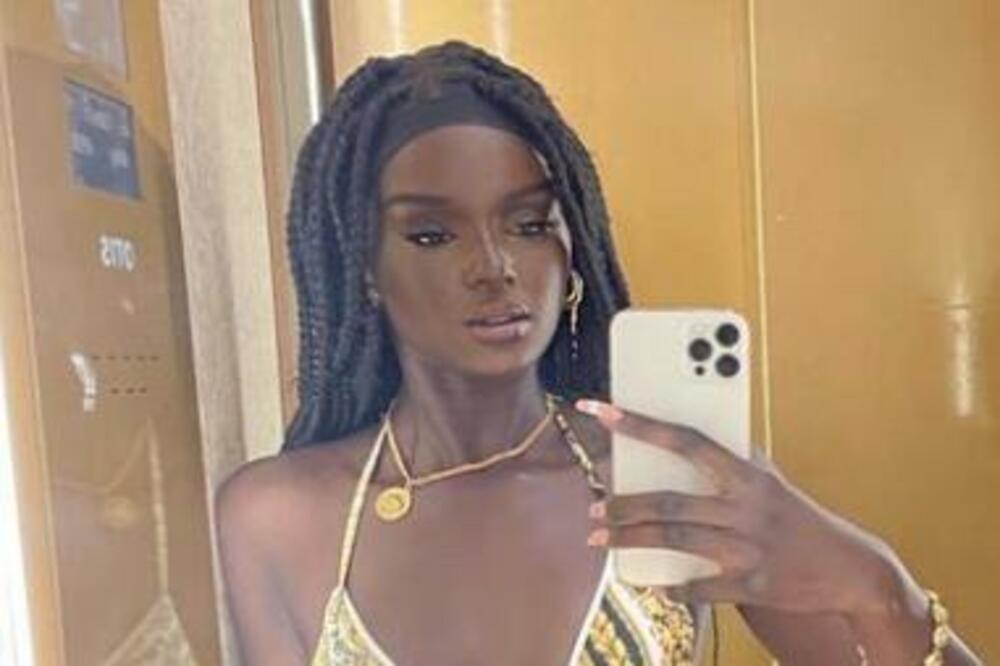 ZOVU JE I ŽIVOM LUTKOM: Ona je toliko lepa da niko ne veruje da JE STVARNA (FOTO)