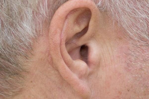 PRLJAVŠTINA U UŠIMA: Pre nego što probate ovo, konsultujte se sa stručnjakom