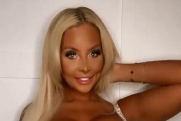 POTROŠILA BOGATSTVO NA OPERACIJE SAMO DA BI IZGLEDALA KAO BARBIKA I NE PLANIRA DA STANE: Više je niko ne prepoznaje