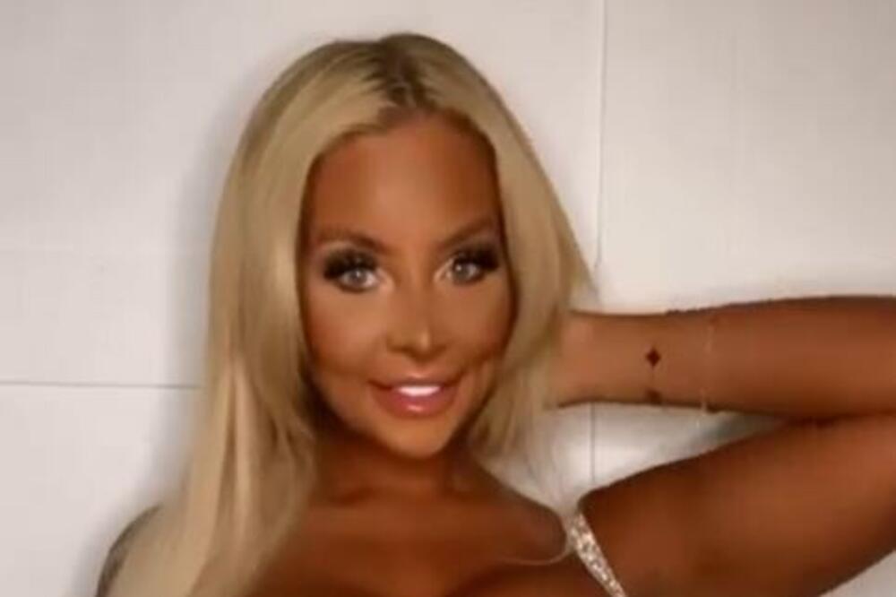 POTROŠILA BOGATSTVO NA OPERACIJE SAMO DA BI IZGLEDALA KAO BARBIKA I NE PLANIRA DA STANE: Više je niko ne prepoznaje