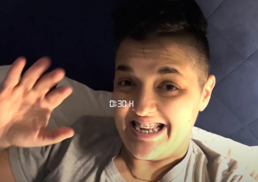 Marija Šerifović stavila fiksnu protezu