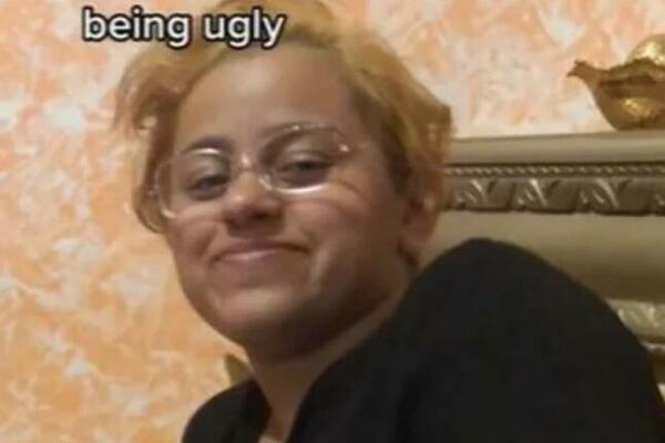 NIKADA NE BISTE PREPOZNALI DEVOJKU SA SLIKE: Danas je "DRUGA OSOBA", zanemećete kad budete videli PROMENU (FOTO)