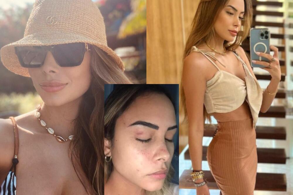 BILA SAM ŽRTVA, ZLOSTAVLJAO ME I TUKAO: Prelepa Brazilka otkrila UNAKAŽENO telo i optužila fudbalera! (FOTO/VIDEO)