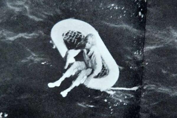 OVA FOTOGRAFIJA DEVOJČICE KRIJE ZLOČIN KOJI LEDI KRV: Jeziv prizor će se zauvek PAMTITI, preživela je PAKAO (FOTO)