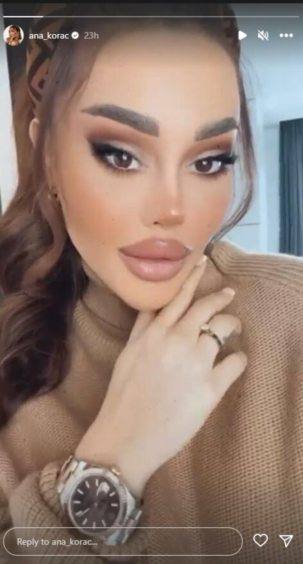 Ana KOrać sa skupocenim satom na ruci