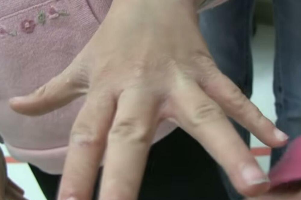 POJAVILA SE ŠUGA U OSNOVNOJ ŠKOLI KOD PROKUPLJA: Odmah obustavljena nastava, oglasio se direktor