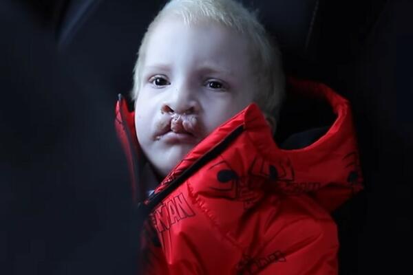 MALI PAVLE IDE NA OPERACIJU REKONSTRUKCIJE VILICE: Njegova PRIČA je RASPLAKALA NACIJU, sada će sve biti DRUGAČIJE!