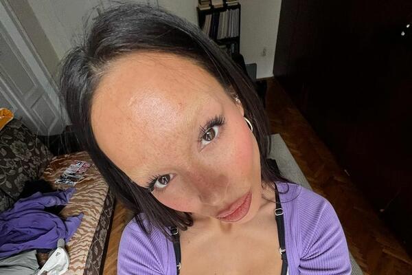 ISCURELE SLIKE EDITE ARADINOVIĆ PRE SVIH PLASTIČNIH OPERACIJA: Evo kako je tada izgledala FOTO