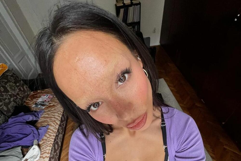 ISCURELE SLIKE EDITE ARADINOVIĆ PRE SVIH PLASTIČNIH OPERACIJA: Evo kako je tada izgledala FOTO