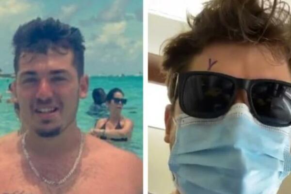 LEGAO DA SPAVA, PA IZGUBIO OKO: Pojelo ga je nešto što svi viđamo, horor! (FOTO)