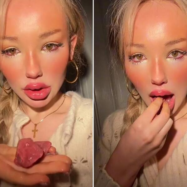 MIMI SVAKI DAN JEDE SIROVO MESO I PIJE ŽIVA JAJA: Ljudi oko nje zabrinuti zbog opasne bolesti, ali ona kaže ovo