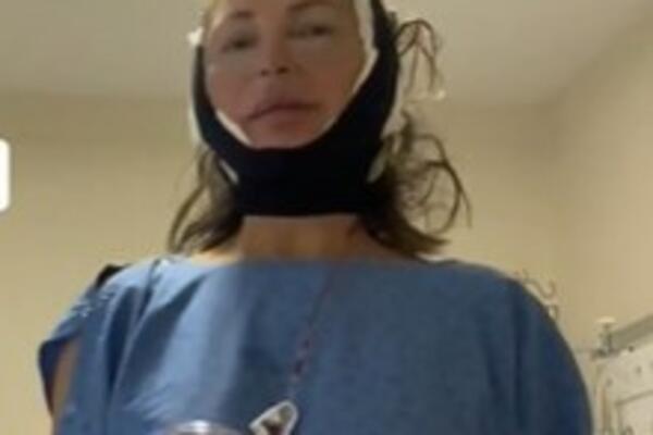 NINA (65) OTIŠLA NA PLASTIČNU OPERACIJU U TURSKU: Dala 8.000 evra, pa pokazala KAKO SADA IZGLEDA (VIDEO)