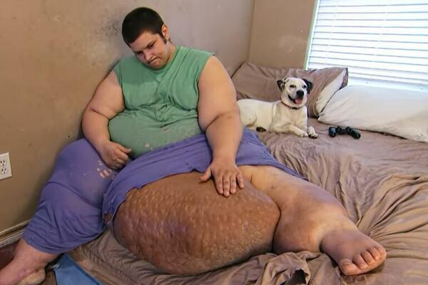 IMAO JE 405 KILOGRAMA I REKLI SU MU DA ĆE UMRETI: Onda je doživeo VELIKU TRANSFORMACIJU, ne biste ga prepoznali