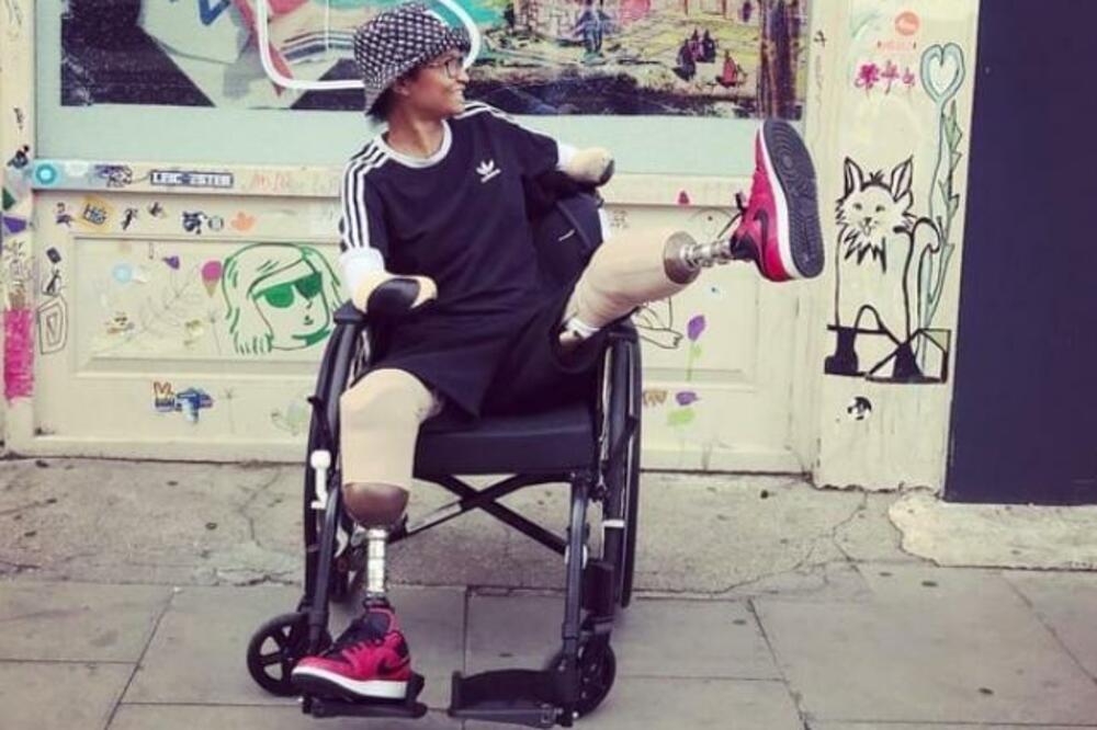 TATJANA SE PROBUDILA BEZ RUKU I NOGU: Pre toga ju je ujeo KOMARAC, a onda je počeo PAKAO! (FOTO)(VIDEO)