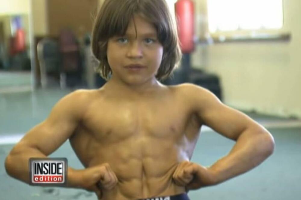 ON JE BIO NAJNABILDOVANIJI DEČAK NA SVETU, A ŽIVOT GA IPAK NIJE MAZIO: Pogledajte samo kako danas IZGLEDA (FOTO)