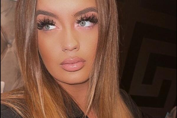 POSTALA MILIONERKA, PA SPISKALA PARE NA SILIKONE: Jedva ostala živa nakon OPEARCIJE, evo kako sada IZGLEDA (FOTO)