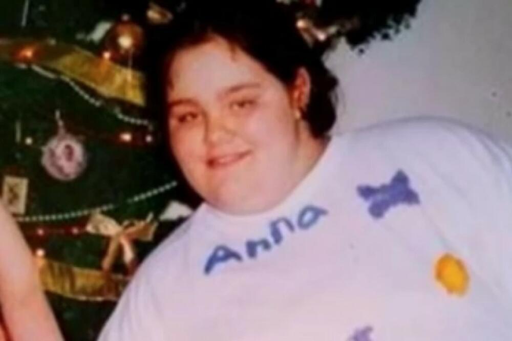 ANA JE SMRŠALA PREKO 150 KILA IZ CUGA: Muškarci bulje u nju zbog izgleda, ali zbog ovoga ne može sebe da pogleda