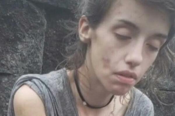 BILA JE POZNATA PEVAČICA, A ONDA JOJ JE DROGA PROMENILA LIČNI OPIS NA GORE: Evo kako danas IZGLEDA (VIDEO)