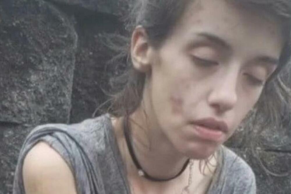 BILA JE POZNATA PEVAČICA, A ONDA JOJ JE DROGA PROMENILA LIČNI OPIS NA GORE: Evo kako danas IZGLEDA (VIDEO)