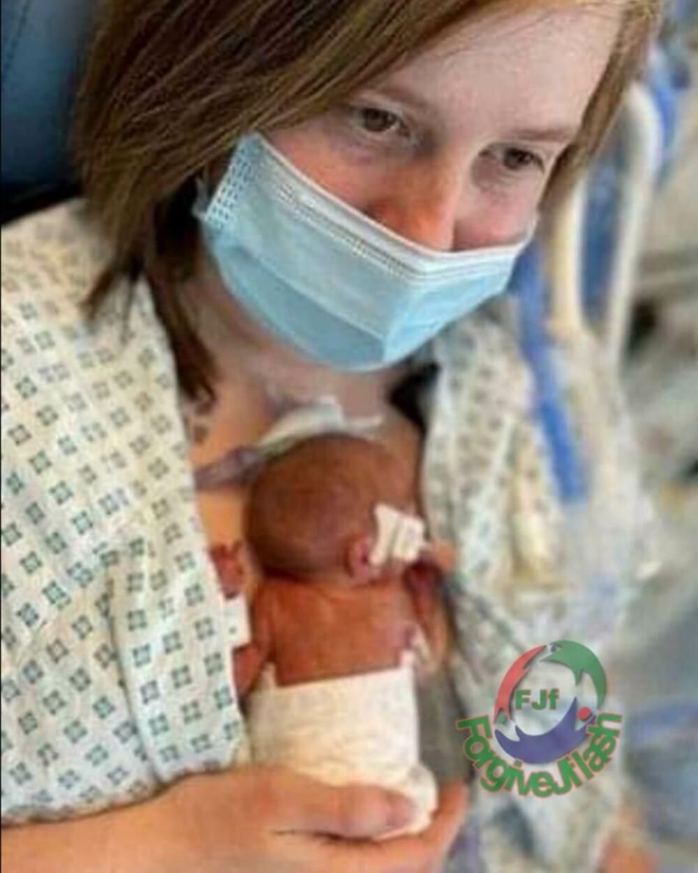 Prevremeno rođena beba