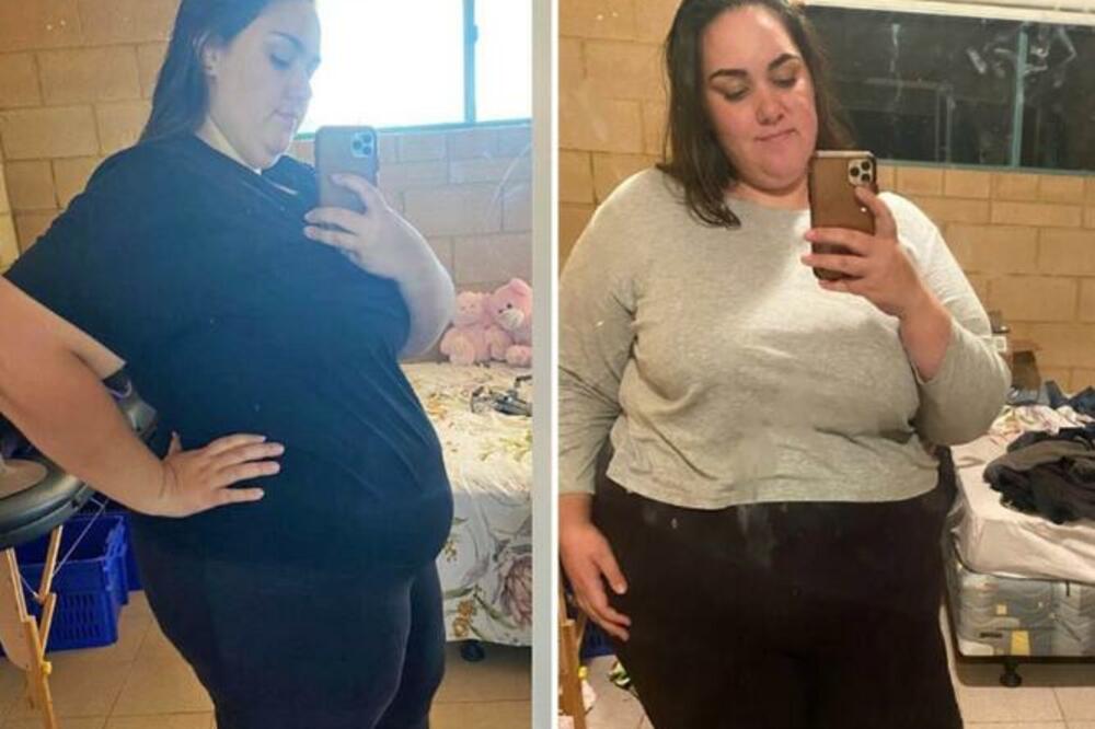 SMRŠALA JE ČAK 100 KILOGRAMA I TO ZBOG 1 STVARI: Doživela je veliku TRANSFORMACIJU, ne biste je PREPOZNALI (FOTO)