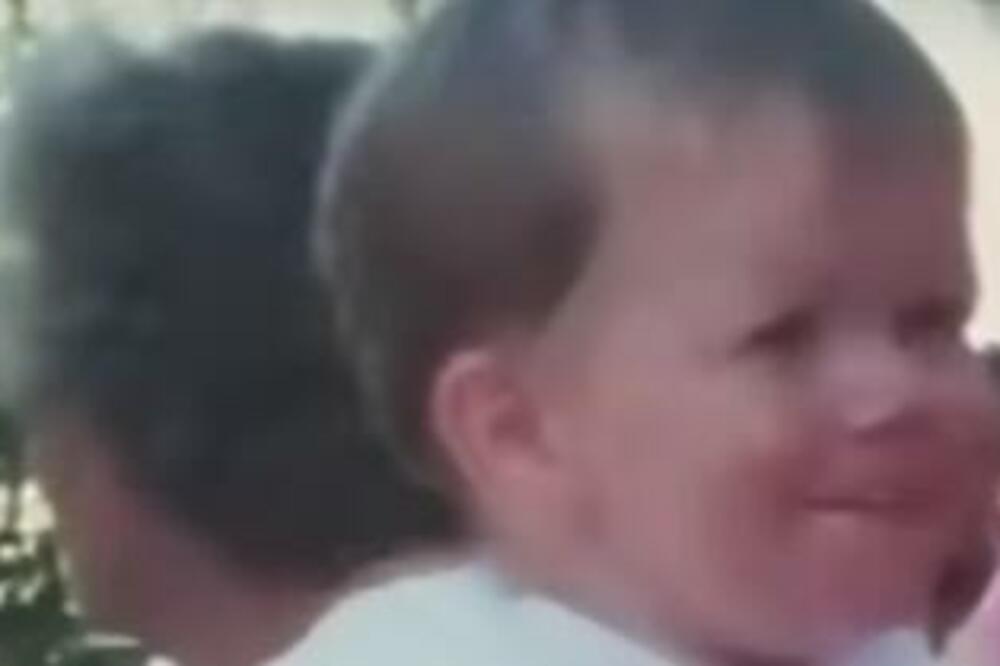 OVA BEBA JE ROĐENA SA VIŠKOM KOŽE, LEKARI NISU VEROVALI ŠTA VIDE: Pogledajte samo kako DANAS IZGLEDA (FOTO)