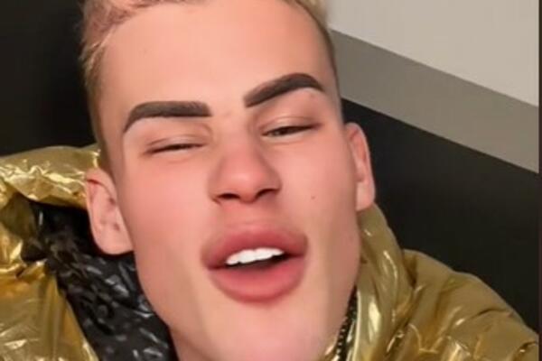 "IZGLEDAŠ KAO PIRANA": Poznati TikToker imao MNOGO plastičnih OPERACIJA, jedna posebno ZGADILA pratioce (VIDEO)