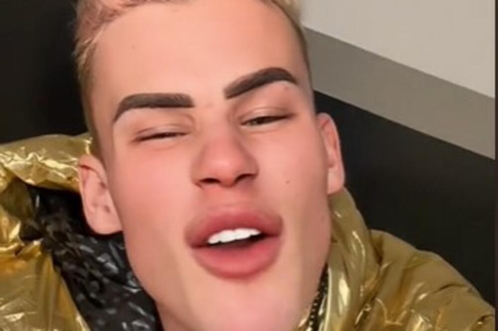 "IZGLEDAŠ KAO PIRANA": Poznati TikToker imao MNOGO plastičnih OPERACIJA, jedna posebno ZGADILA pratioce (VIDEO)