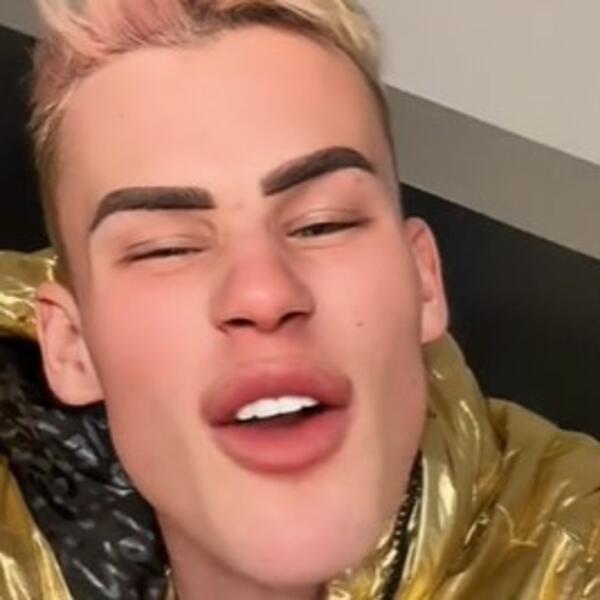 "IZGLEDAŠ KAO PIRANA": Poznati TikToker imao MNOGO plastičnih OPERACIJA, jedna posebno ZGADILA pratioce (VIDEO)