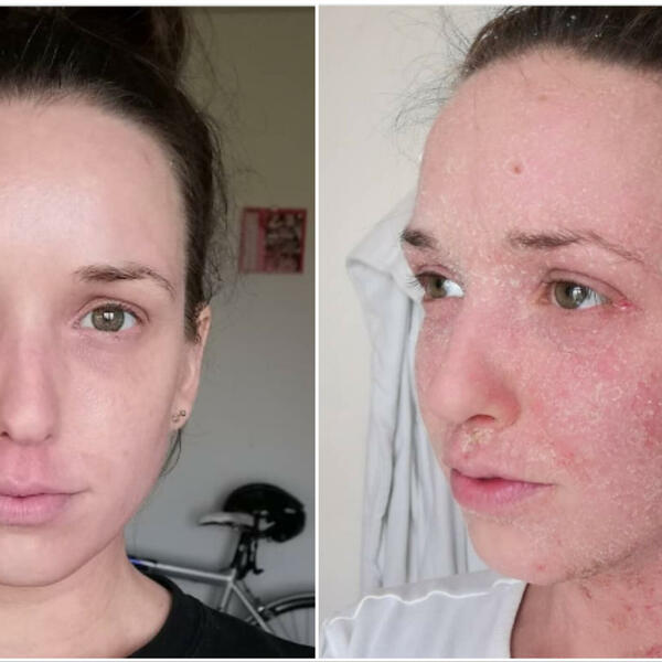 POLJUBILA JE LJUBIMCA, A KADA SE POGLEDALA U OGLEDALO DOŽIVELA JE ŠOK: Na licu pravi užas, šta je ovo? (FOTO)