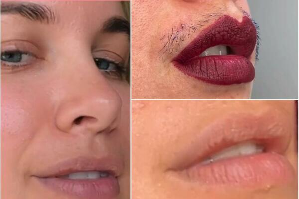 POSTAVILA JE SLIKE SVOJIH DLAKA NA USNAMA, ALI TU NIJE KRAJ: Sad je otišla korak dalje, gledajte samo ovo (VIDEO)