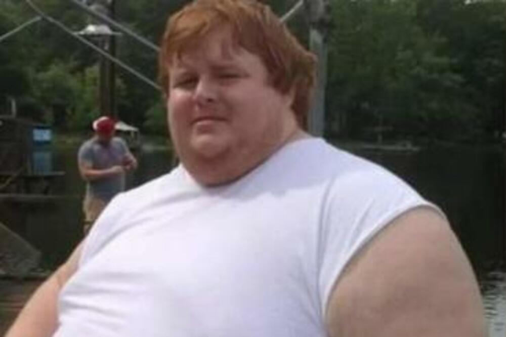 IMAO JE SKORO 400 KILOGRAMA I MORAO DA ODE NA OPERACIJU: Valjao se po kući, nije mogao da STANE NA NOGE (FOTO)