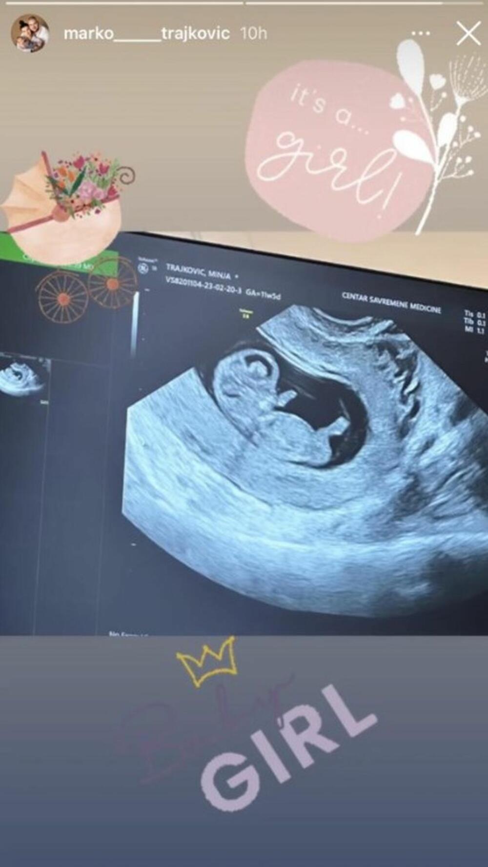 Đani je presrećan zbog dolaska unuke