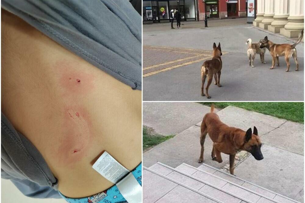 RAZJARENE MALINOE IZGRIZLE DETE NA IGRALIŠTU U SUBOTICI: Psi oduzeti vlasniku, sejali strah u GRADU! (FOTO)