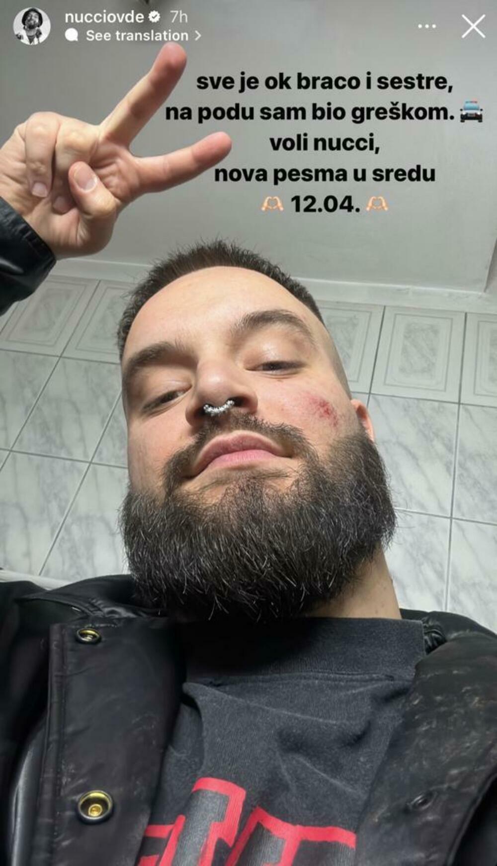 Muzičar se oglasio nakon pucnjave u Beton hali