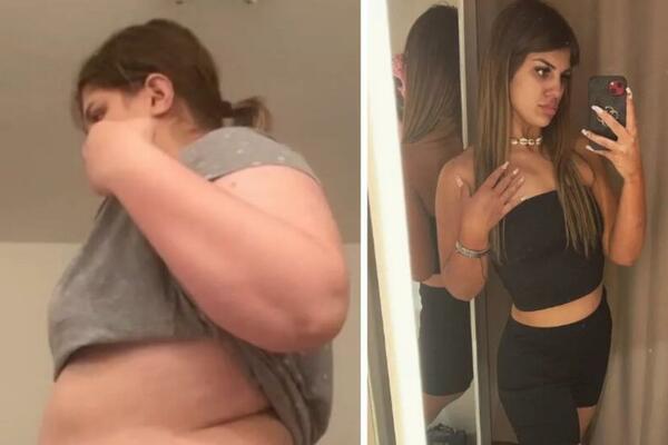 MILICU JE DEČKO OSTAVIO PRED SVADBU JER JE IMALA 135 KG: Prepolovila se i sada NIKO NE SKIDA POGLED SA NJE (FOTO)