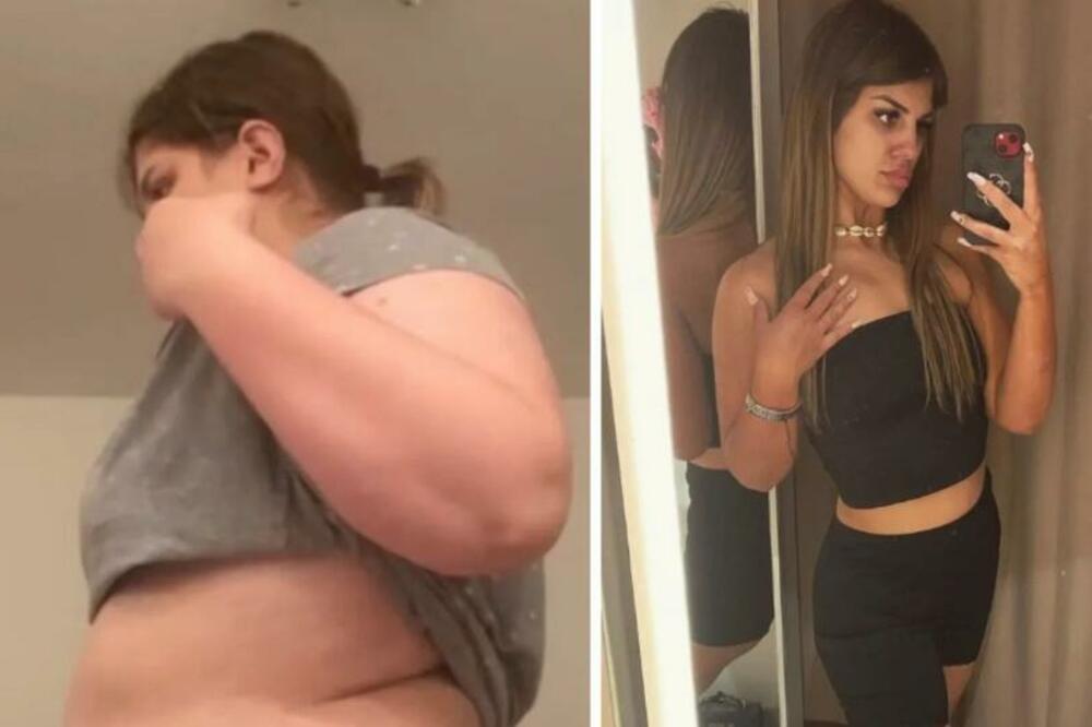 MILICU JE DEČKO OSTAVIO PRED SVADBU JER JE IMALA 135 KG: Prepolovila se i sada NIKO NE SKIDA POGLED SA NJE (FOTO)