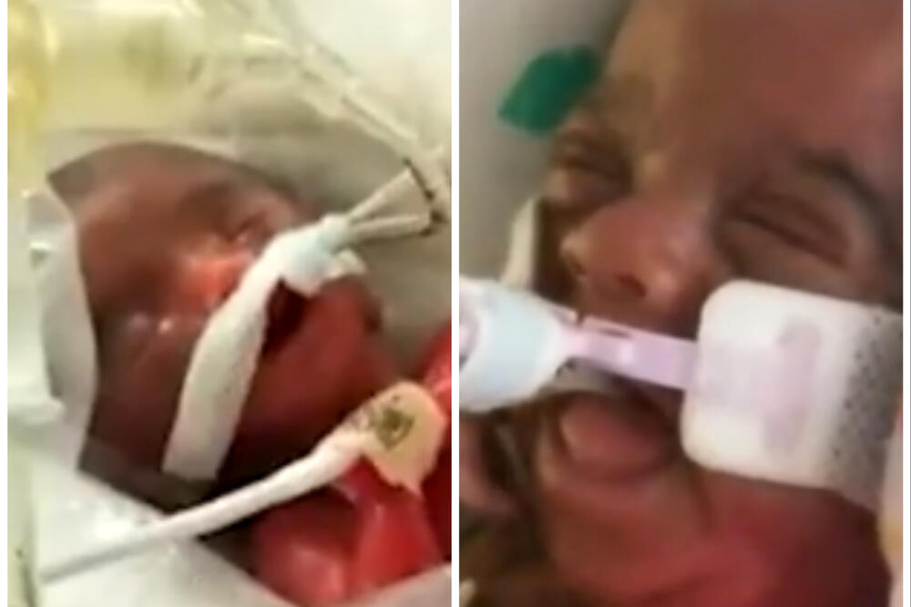OVE 2 BEBE SU ROĐENE SU SA SAMO 750 GRAMA: Majci rekli da neće PREŽIVETI, a evo kako IZGLEDAJU DANAS (FOTO)