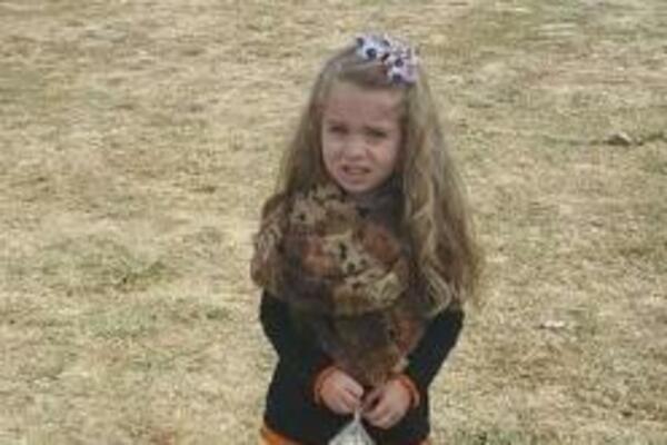 ŠTA NIJE U REDU SA NOGAMA OVE DEVOJČICE? Fotografija izazvala OPŠTI HAOS, ostaćete BEZ REČI (FOTO)